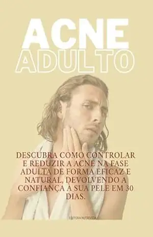 Capa do livro ACNE:ADULTO: Descubra como controlar e reduzir a acne na fase adulta de forma eficaz e natural (Superalimentos para a Saúde) - GUILHERMINA BRITES