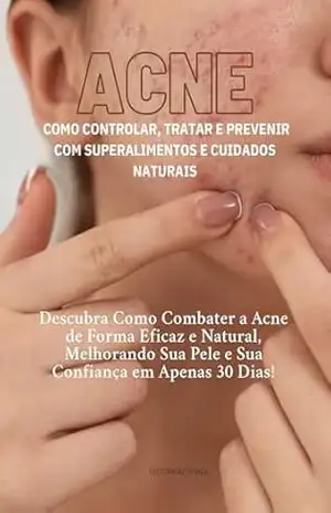 ACNE: Como Controlar, Tratar e Prevenir Com Superalimentos e Cuidados Naturais: Descubra Como Combater a Acne de Forma Eficaz e Natural, Melhorando Sua … Dias! (Superalimentos para a Saúde Livro 1) – GUILHERMINA BRITES