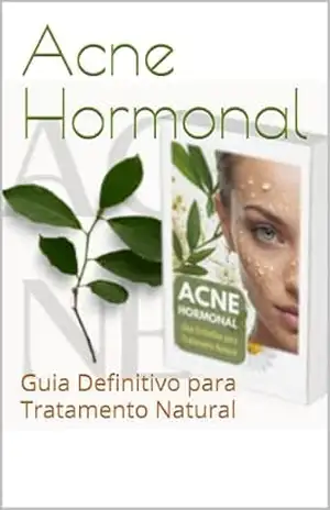 Capa do livro Acne Hormonal: Guia Definitivo para Tratamento Natural - Flavia Ibs