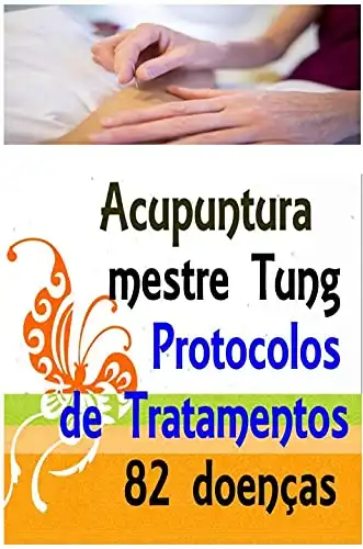 Baixar Acupuntura do mestre Tung – Protocolos de tratamentos – 82 doenças pdf, epub, mobi, eBook