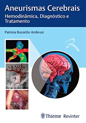 Baixar Aneurismas Cerebrais: Hemodinâmica, Diagnóstico e Tratamento pdf, epub, mobi, eBook