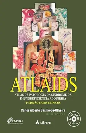 ATLAIDS – Atlas de Patologia da Síndrome da Imunodeficiência Adquirida – 2ª Edição (eBook) (0) – Carlos Alberto Basilio-de-Oliveira