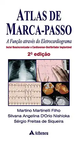 Baixar Atlas de Marca Passo – A Função Através do Eletrocardiograma pdf, epub, mobi, eBook