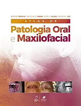 Baixar Atlas de Patologia Oral e Maxilofacial pdf, epub, mobi, eBook