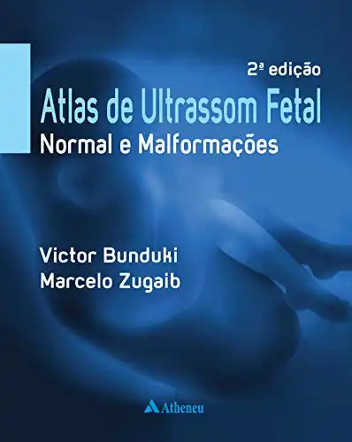 Baixar Atlas de Ultrassom Fetal Normal e Malformações - 2ª Edição pdf, epub, mobi, eBook