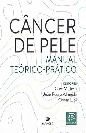 Capa do livro Câncer de pele: manual teórico–prático - Curt M. Treu