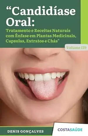 Candidíase Oral: Tratamento e Receitas Naturais com Ênfase em Plantas Medicinais, Capsulas, Extratos e Chás – Volume 139 – Denis  Gonçalves