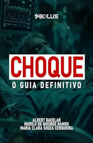 Choque: O Guia Definitivo (In Bolusa) – Albert Bacelar