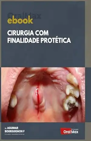 Cirurgia com Finalidade Protética – Aguimar de Matos Bourguignon Filho