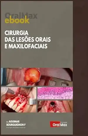 Cirurgia das Lesões Orais e Maxilofaciais – Aguimar de Matos Bourguignon Filho