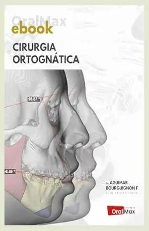 Cirurgia Ortognática – Aguimar de Matos Bourguignon Filho