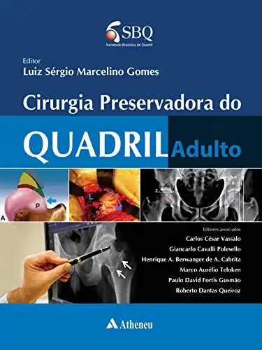Baixar Cirurgia Preservadora do Quadril Adulto pdf, epub, mobi, eBook