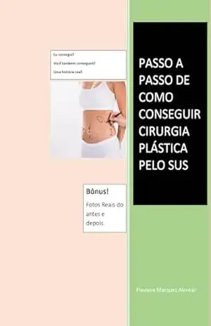 Como conseguir cirurgia plástica pelo SUS grátis: Cirurgia Plástica Grátis - Flaviana Marques Alencar Como conseguir cirurgia plástica pelo SUS grátis: Cirurgia Plástica Grátis - Flaviana Marques Alencar