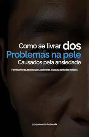 COMO SE LIVRAR DOS SINTOMAS DA ANSIEDADE NA PELE: FORMIGAMENTOS, QUEIMAÇÕES, ARDÊNCIAS, PICADAS, PONTADAS, FEBRES E OUTROS – Paulo Antonio Alves de Almeida
