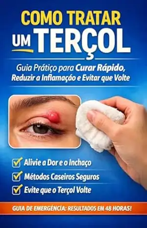 Capa do livro Como Tratar um Terçol – Guia Prático para Curar Rápido, Reduzir a Inflamação e Evitar que Volte: Tratamentos caseiros, cuidados essenciais e prevenção para eliminar o terçol com segurança - Leandro Silveira
