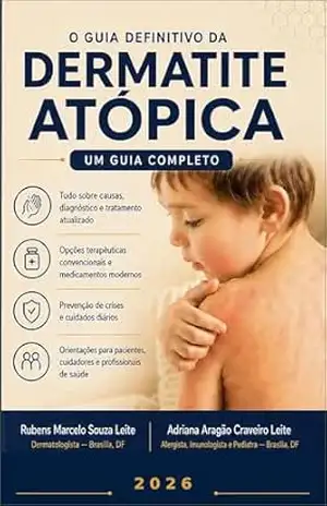 Dermatite Atópica: Um guia claro e prático para entender, tratar e viver melhor com dermatite atópica – Rubens Souza Leite Dermatite Atópica: Um guia claro e prático para entender, tratar e viver melhor com dermatite atópica – Rubens Souza Leite