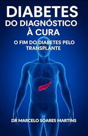 Diabetes, do diagnóstico à cura: O fim do diabetes pelo Transplante - Dr Marcelo  Soares Martins