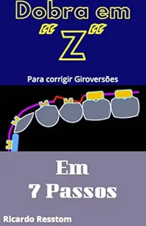 Capa do livro Dobra em ''Z'' em 7 passos – Parte I: Corrigindo as Giro–Versões (Ortodontia: Como confeccionar uma Dobra em ''Z'' em 7 passos) - Ricardo Resstom