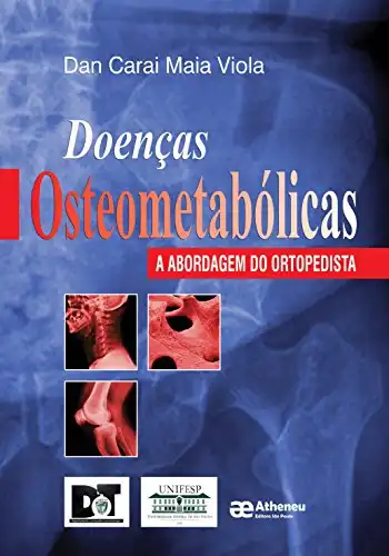 Baixar Doenças Osteometabólicas pdf, epub, mobi, eBook