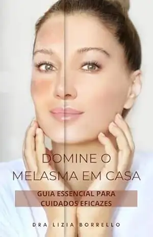 Domine o Melasma em Casa: Guia Essencial para Cuidados Eficazes.: Guia detalhado, oferecendo estratégias práticas e produtos recomendados para gerenciar o melasma de forma eficaz. - Lizia Borrello Domine o Melasma em Casa: Guia Essencial para Cuidados Eficazes.: Guia detalhado, oferecendo estratégias práticas e produtos recomendados para gerenciar o melasma de forma eficaz. - Lizia Borrello