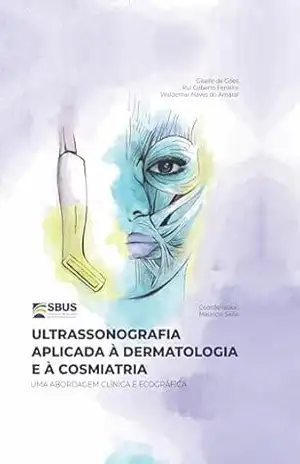 E–Book Ultrassonografia Aplicada à Dermatologia e à Cosmiatria – Waldemar  Naves do Amaral