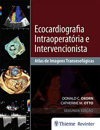 Baixar Ecocardiografia Intraoperatória e Intervencionista: Atlas de Imagens Tansesofágicas pdf, epub, mobi, eBook