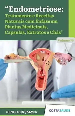 Endometriose: Tratamento e Receitas Naturais com Ênfase em Plantas Medicinais, Capsulas, Extratos e Chás – Volume 79 – Denis  Gonçalves