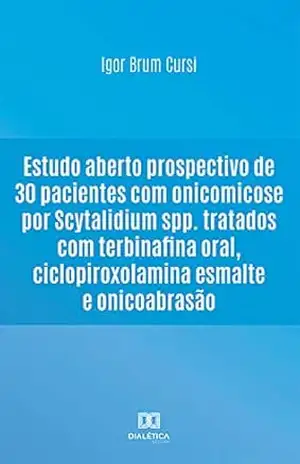 Estudo aberto prospectivo de 30 pacientes com onicomicose por Scytalidium spp. tratados com terbinafina oral, ciclopiroxolamina esmalte e onicoabrasão – Igor Brum Cursi Estudo aberto prospectivo de 30 pacientes com onicomicose por Scytalidium spp. tratados com terbinafina oral, ciclopiroxolamina esmalte e onicoabrasão – Igor Brum Cursi