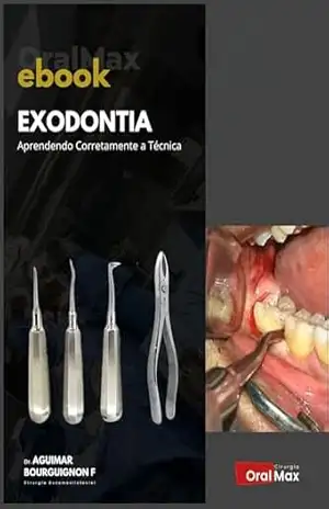 Capa do livro Exodontia. Aprendendo Corretamente a Técnica - Aguimar de Matos Bourguignon Filho