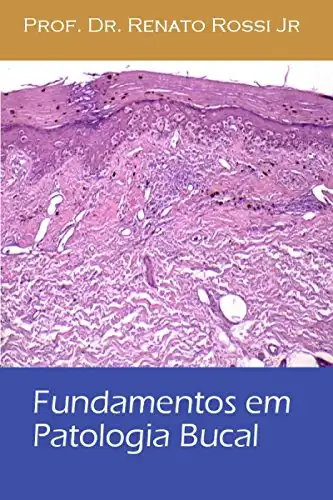 Baixar Fundamentos em patologia bucal pdf, epub, mobi, eBook