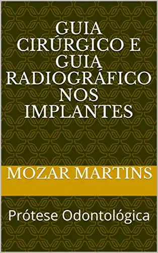 Baixar Guia Cirúrgico e Guia Radiográfico nos Implantes: Prótese Odontológica pdf, epub, mobi, eBook