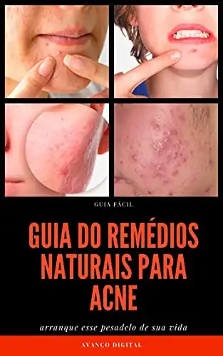 Baixar Guia dos Remédios Naturais Para Acne CRAVOS E ESPINHA pdf, epub, mobi, eBook
