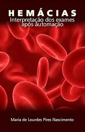 Hemácias – Interpretação dos Exames após Automação – Maria de Lourdes Pires Nascimento