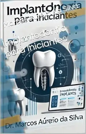 Capa do livro Implantodontia para Iniciantes - Marcos  Aurélio da Silva