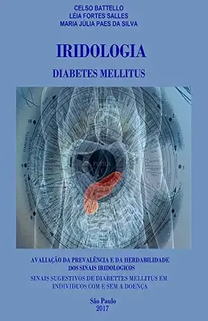 Iridologia – Diabetes Mellitus: Avaliação Da Prevalência E Da Herdabilidade dos Sinais Iridológicos – Maria Julia Paes da Salles, Léia Fortes , Silva
