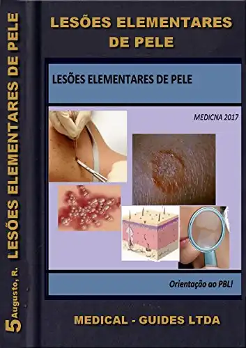 Baixar Lesões Elementares de Pele: Manual pratico das lesões epiteliais (MedBook) pdf, epub, mobi, eBook