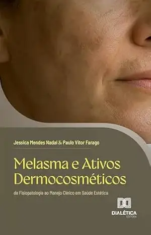 Melasma e Ativos Dermocosméticos: da Fisiopatologia ao Manejo Clínico em Saúde Estética - Jessica Mendes Nadal Melasma e Ativos Dermocosméticos: da Fisiopatologia ao Manejo Clínico em Saúde Estética - Jessica Mendes Nadal