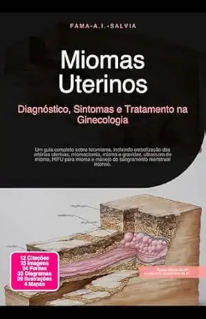 Miomas Uterinos: Diagnóstico, Sintomas e Tratamento na Ginecologia – Fama A.I. Salvia