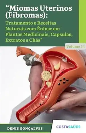 Miomas Uterinos (Fibromas): Tratamento e Receitas Naturais com Ênfase em Plantas Medicinais, Capsulas, Extratos e Chás – Volume 54 – Denis  Gonçalves
