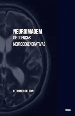Capa do livro Neuroimagem de Doenças Neurodegenerativas - Fernando Belomé Feltrin
