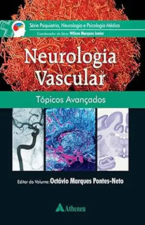 Neurologia Vascular: Tópicos Avançados (eBook) (0) – Octávio Marques Pontes-Neto Neurologia Vascular: Tópicos Avançados (eBook) (0) – Octávio Marques Pontes-Neto