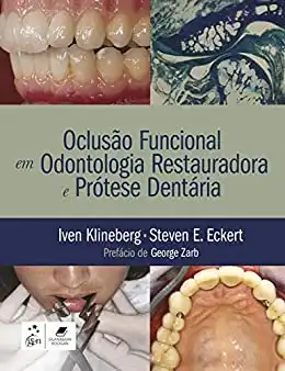 Baixar Oclusão Funcional em Odontologia Restauradora e Prótese Dentária pdf, epub, mobi, eBook