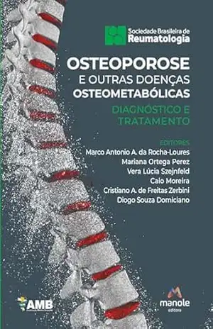 Osteoporose e outras doenças osteometabólicas: diagnóstico e tratamento – Marco Antonio Araújo da Rocha-Loures