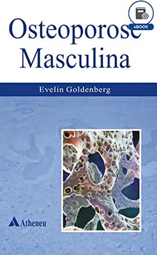 Baixar Osteoporose Masculina (eBook) pdf, epub, mobi, eBook