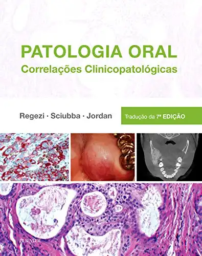 Baixar Patologia Oral pdf, epub, mobi, eBook