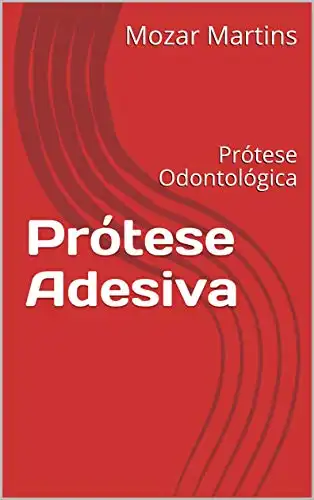 Baixar Prótese Adesiva: Prótese Odontológica pdf, epub, mobi, eBook