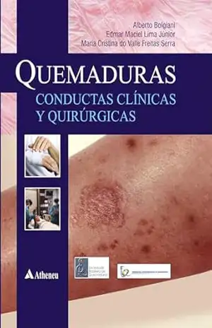Capa do livro Quemaduras – Conductas Clinicas Y Quirurgicas (eBook) - Edmar Maciel Lima Júnior