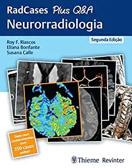 Baixar RadCases Plus Q&A Neurorradiologia pdf, epub, mobi, eBook