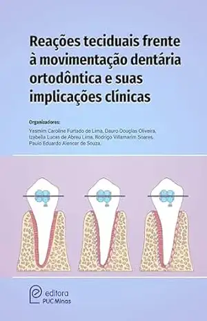 Reações teciduais frente à movimentação dentária ortodóntica e suas implicações clínicas – Editora PUC Minas