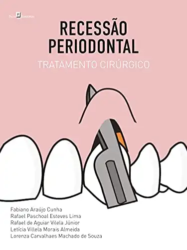 Baixar Recessão Periodontal: Tratamento Cirúrgico pdf, epub, mobi, eBook